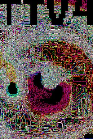 TTV4